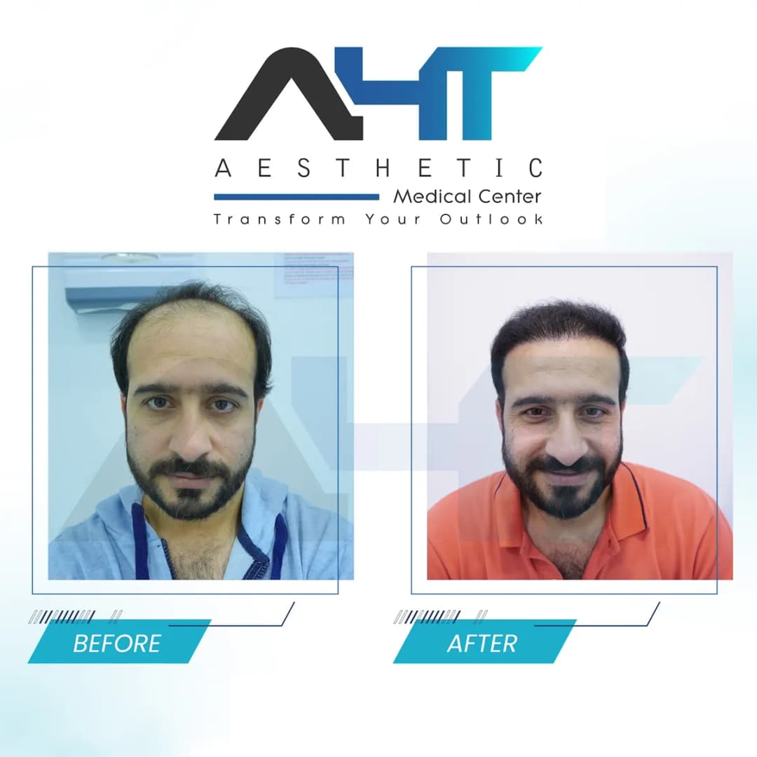 A H T Aesthetic Medical Center — صورة 7