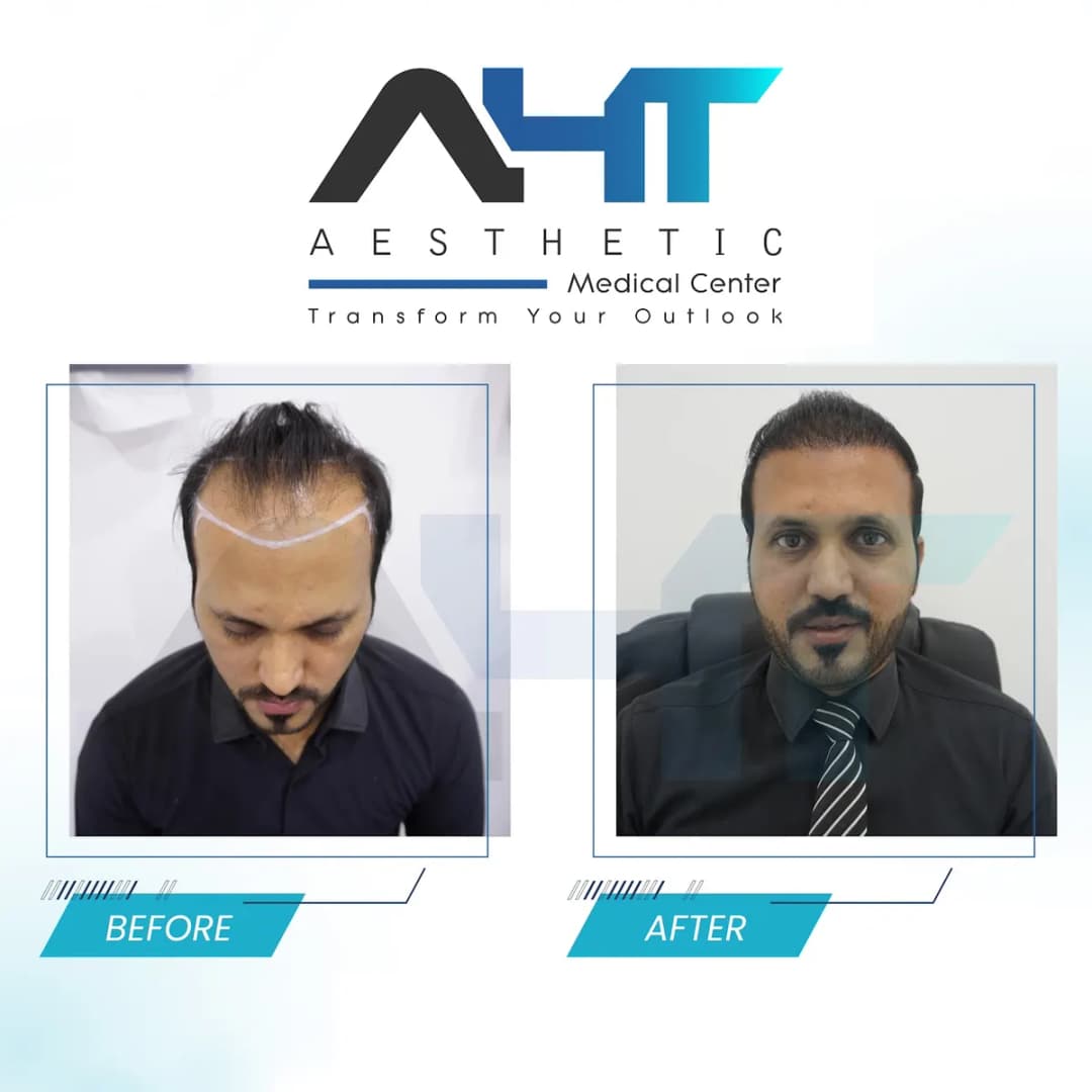 A H T Aesthetic Medical Center — صورة 8