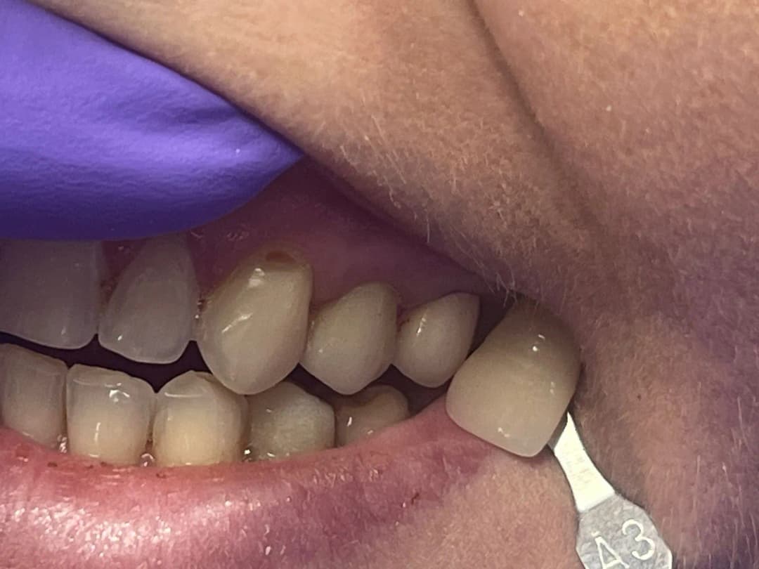 Araks Dental Clinic — صورة 6
