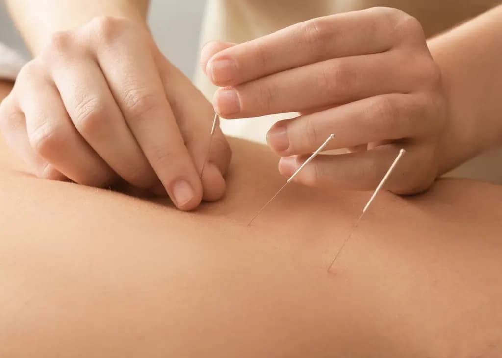 Beijing Wellbeing Acupuncture Therapy Center — صورة 7