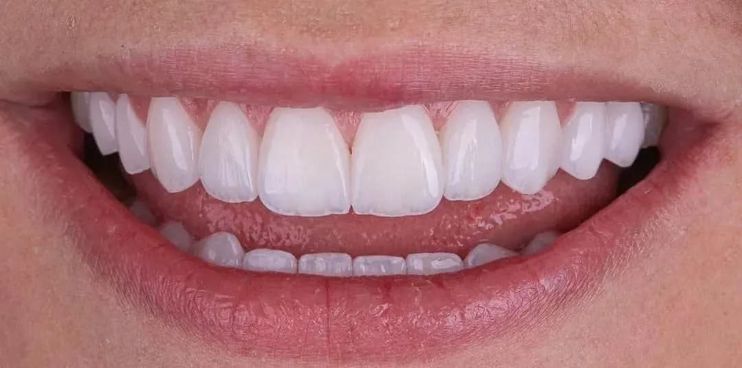 Cosmetic Art Dental Clinic — صورة 8