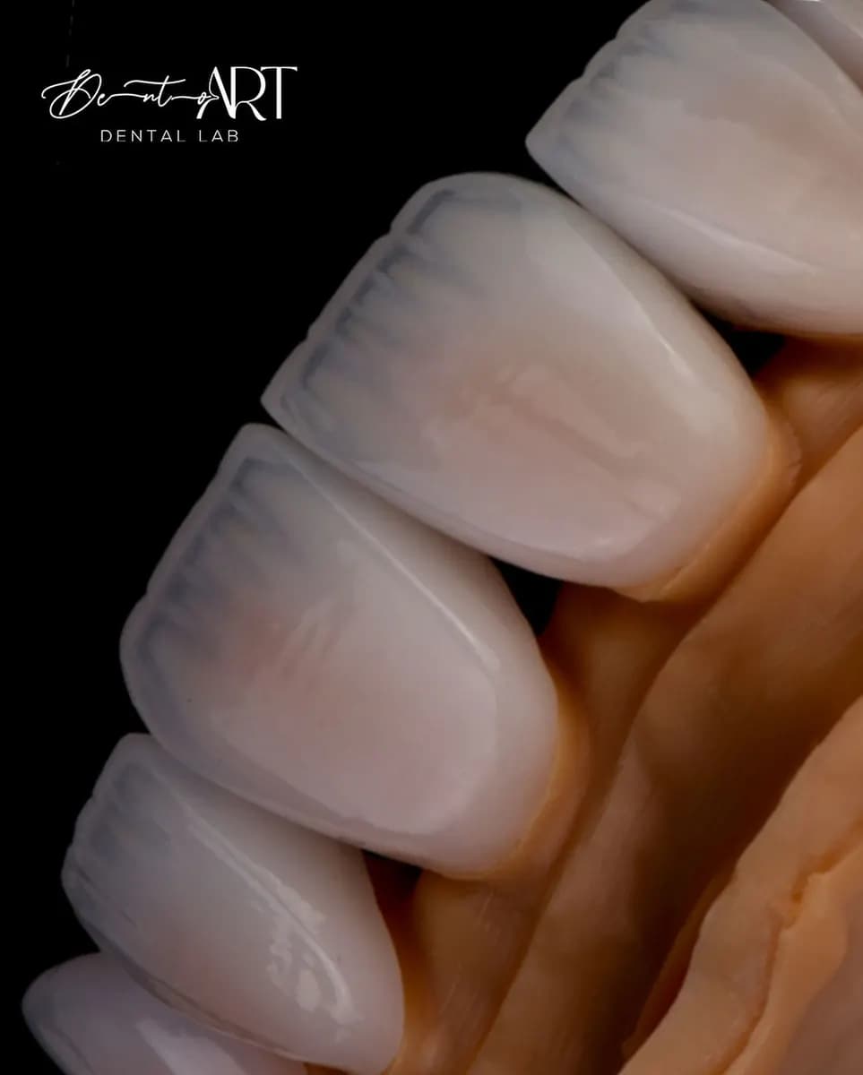 Dento Art Dental Lab photo 5