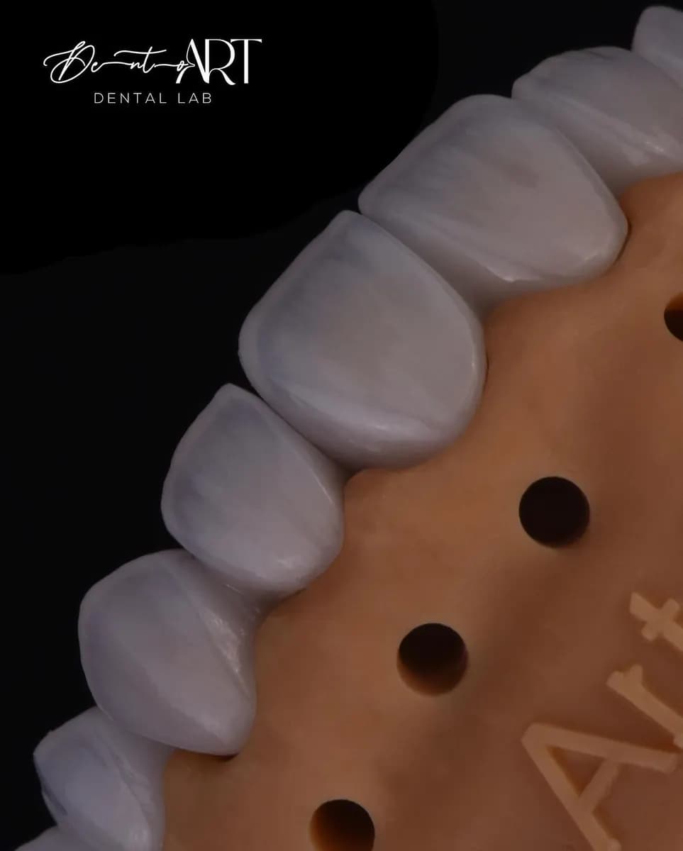 Dento Art Dental Lab — صورة 6