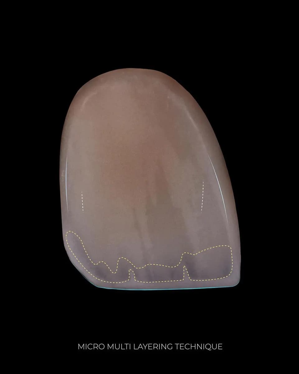 Dento Art Dental Lab — صورة 7