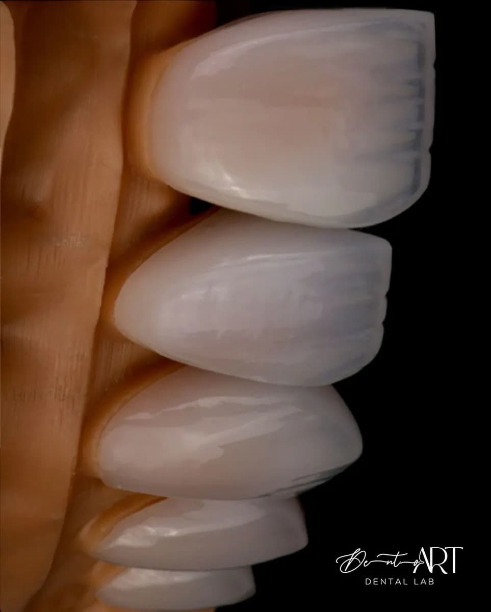 Dento Art Dental Lab — صورة 8
