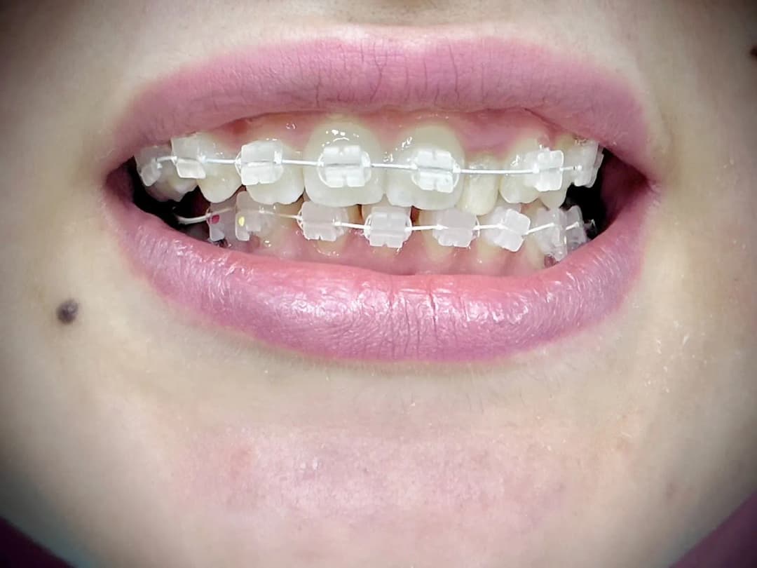 DR Alaa Dental Beauty Clinic photo 4