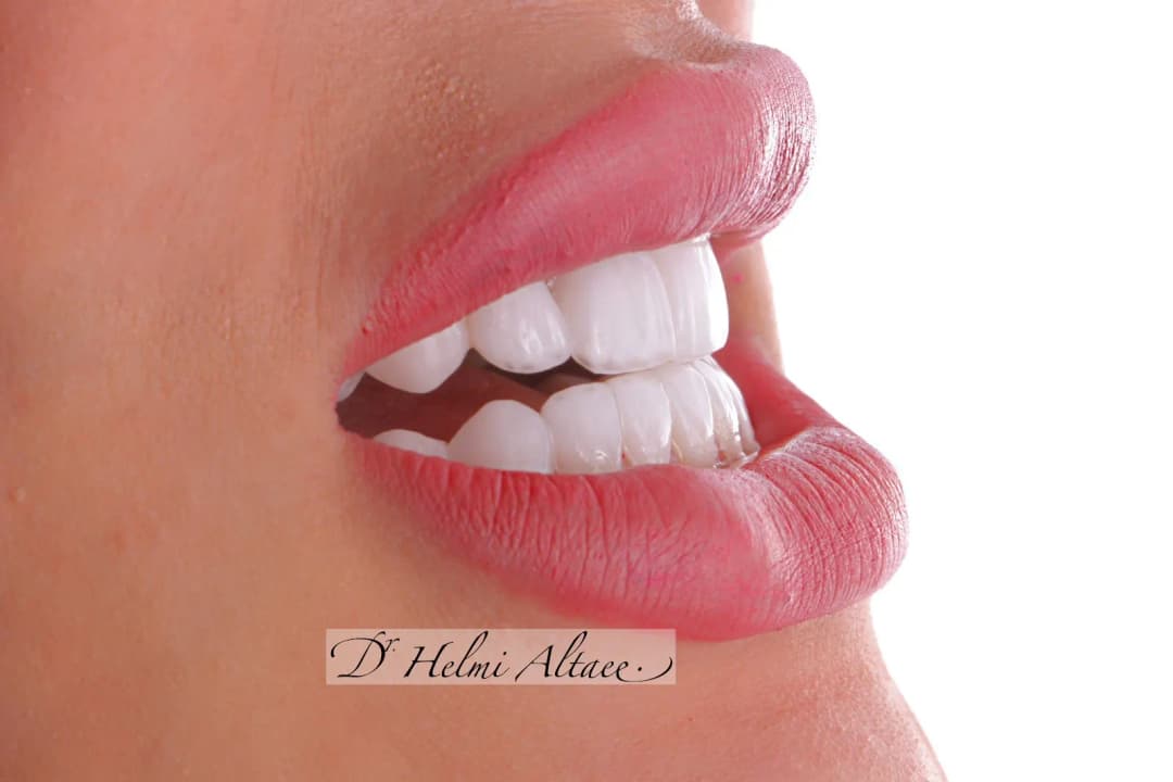DR Helmi S Specialized Implantology & Dental Center photo 3