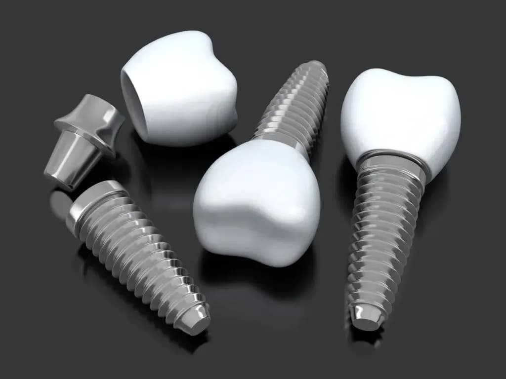 DR Helmi S Specialized Implantology & Dental Center photo 4