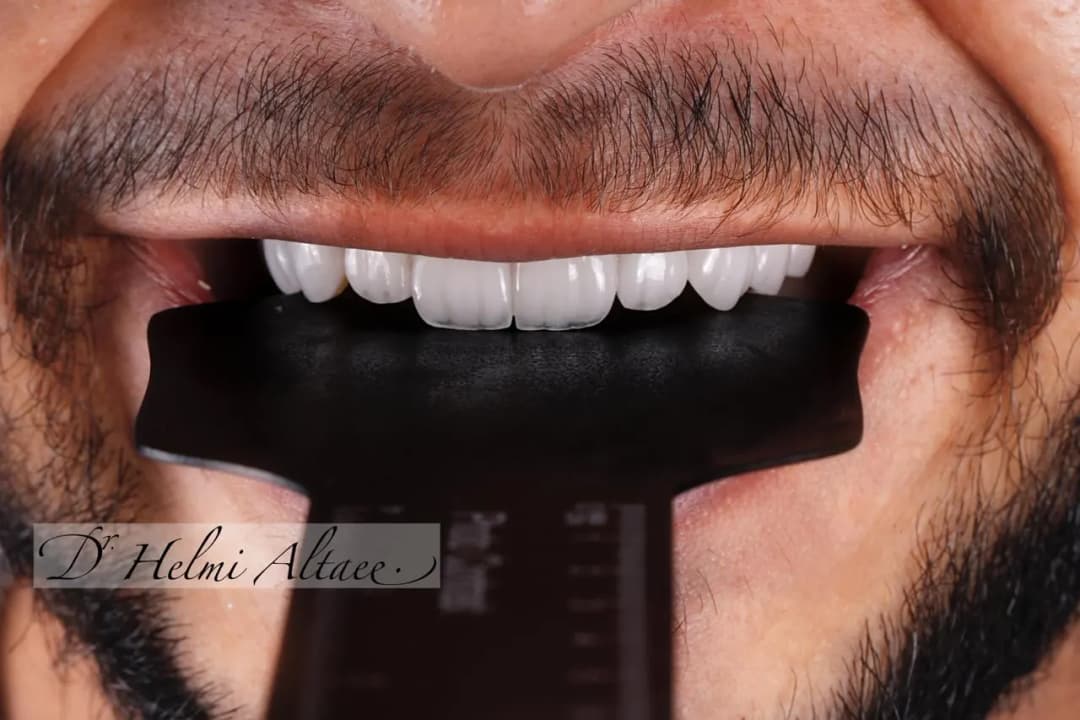 DR Helmi S Specialized Implantology & Dental Center — صورة 6