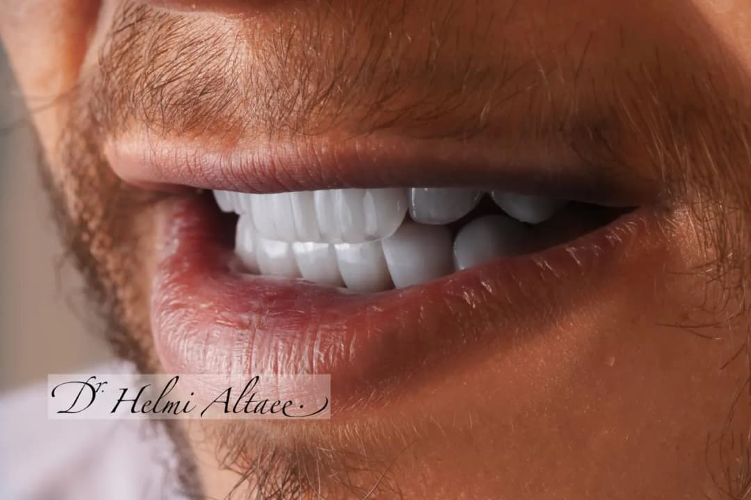 DR Helmi S Specialized Implantology & Dental Center — صورة 7