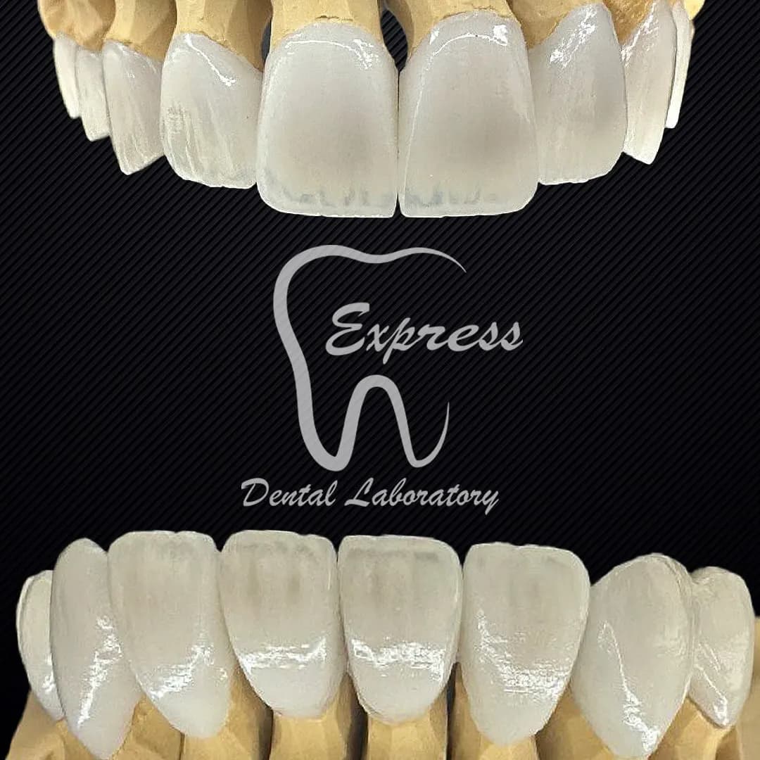 Express Dental Lab