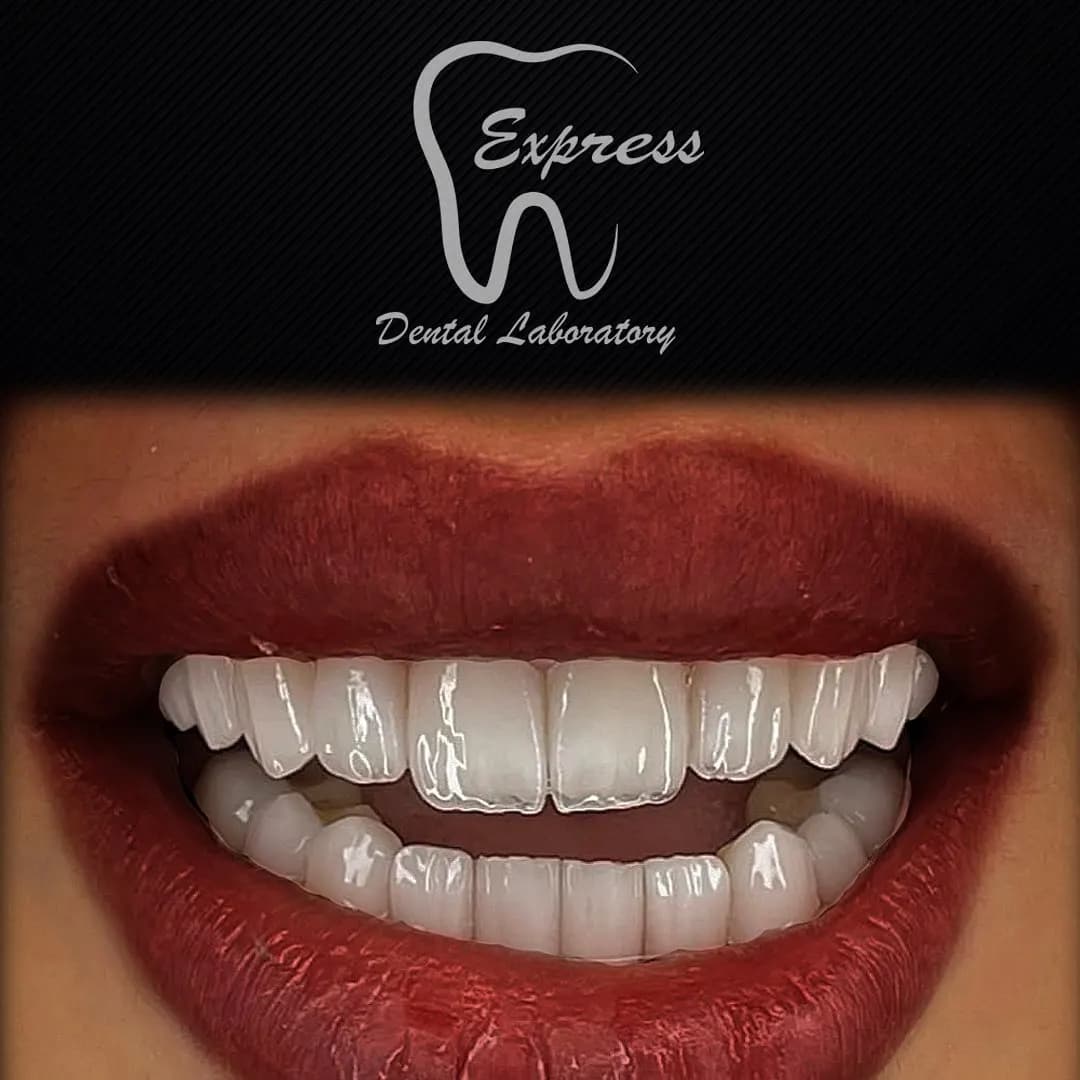 Express Dental Lab photo 4