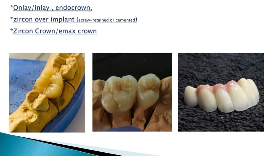 Express Dental Lab — صورة 7