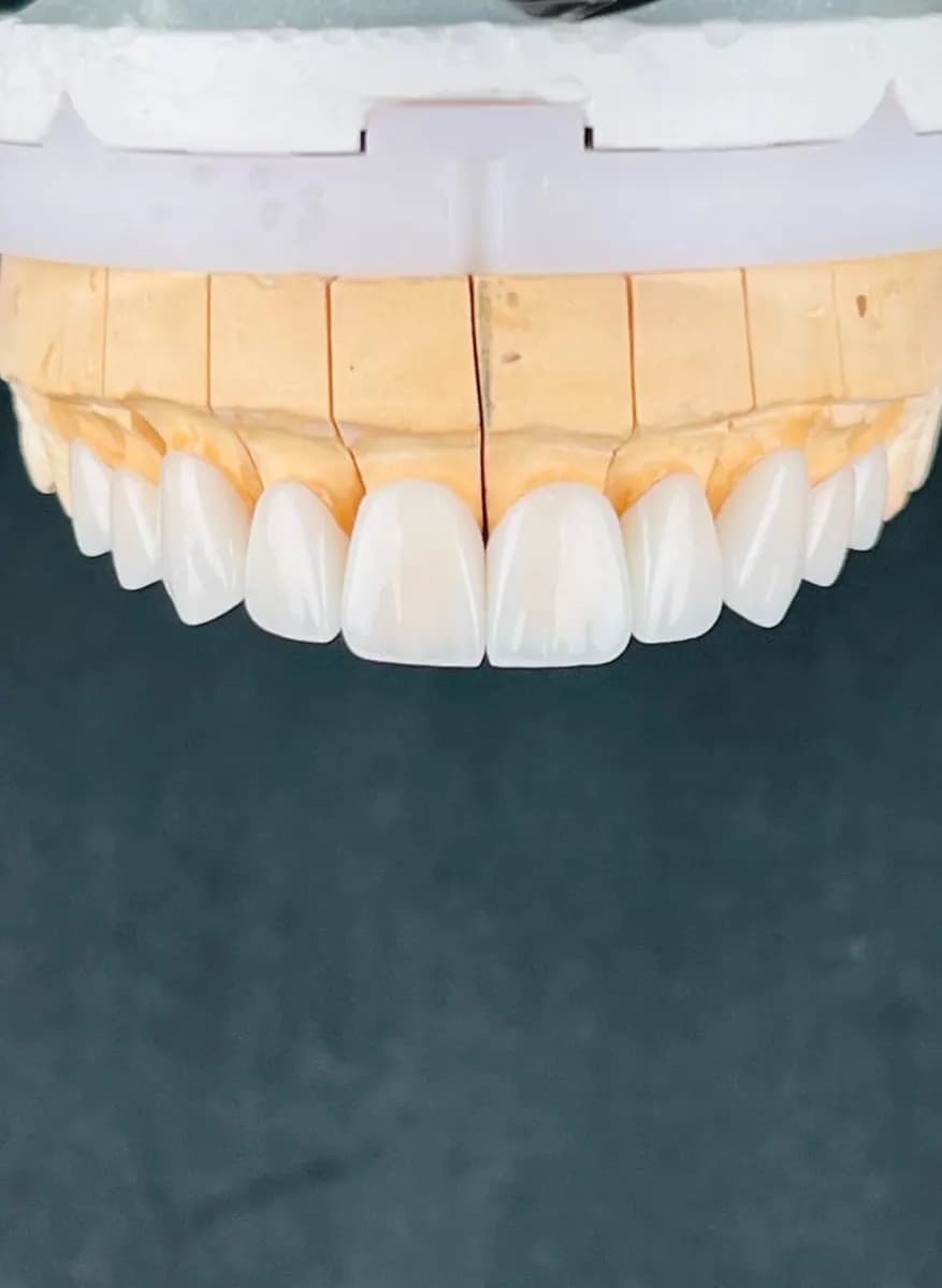 glory smile Dental Laboratory photo 3