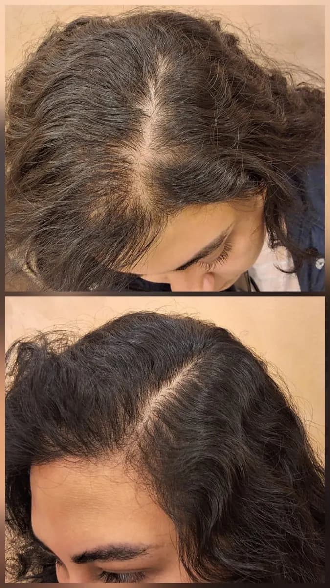 Halcyon Aesthetics Clinic — صورة 8