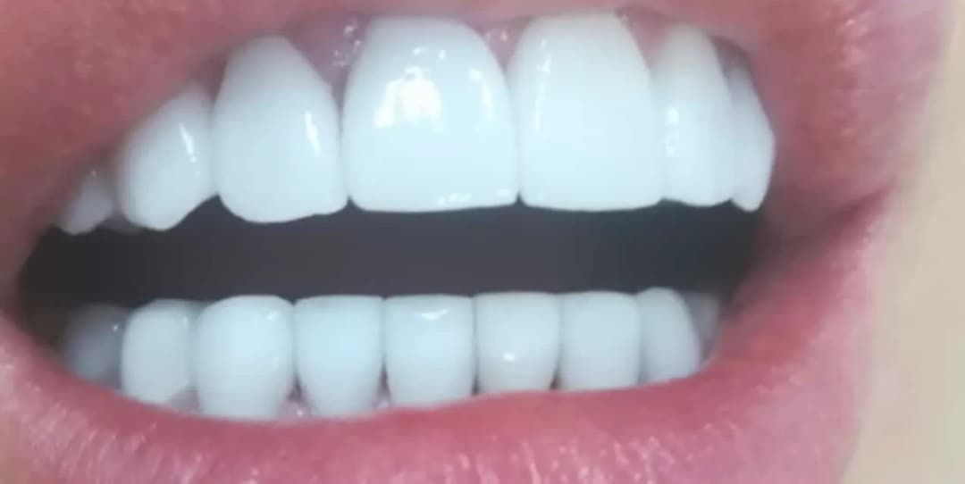 Healthy Smile Clinic photo 5