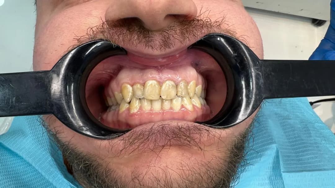 Highrise Dental Clinic — صورة 8