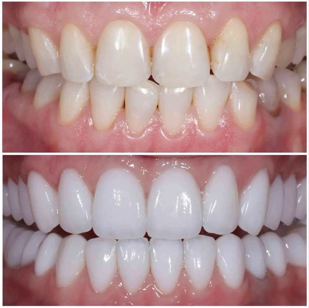 Kravtsov Dental Laboratory