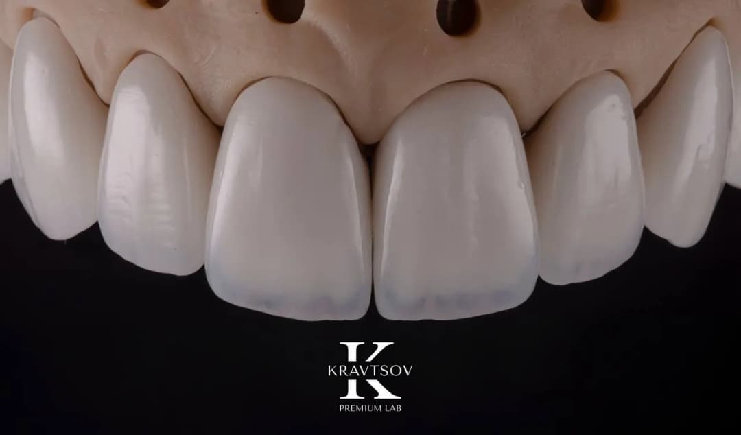 Kravtsov Dental Laboratory photo 4
