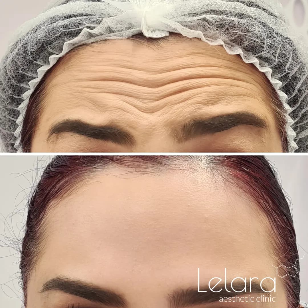 Lelara Aesthetic Clinic — صورة 8