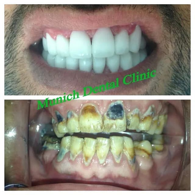 Munich Dental Clinic — صورة 6