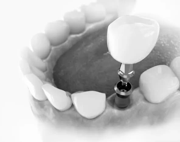 Noa Dental Clinic — صورة 8
