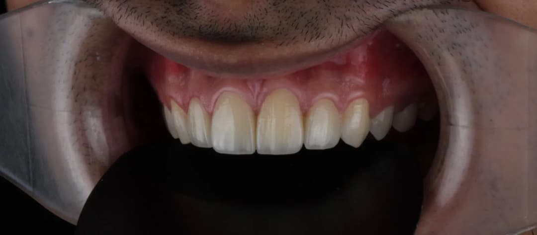 NOBLE Dental laboratory