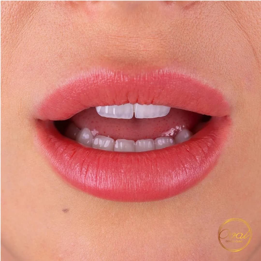 Oval Dental Clinic — صورة 4