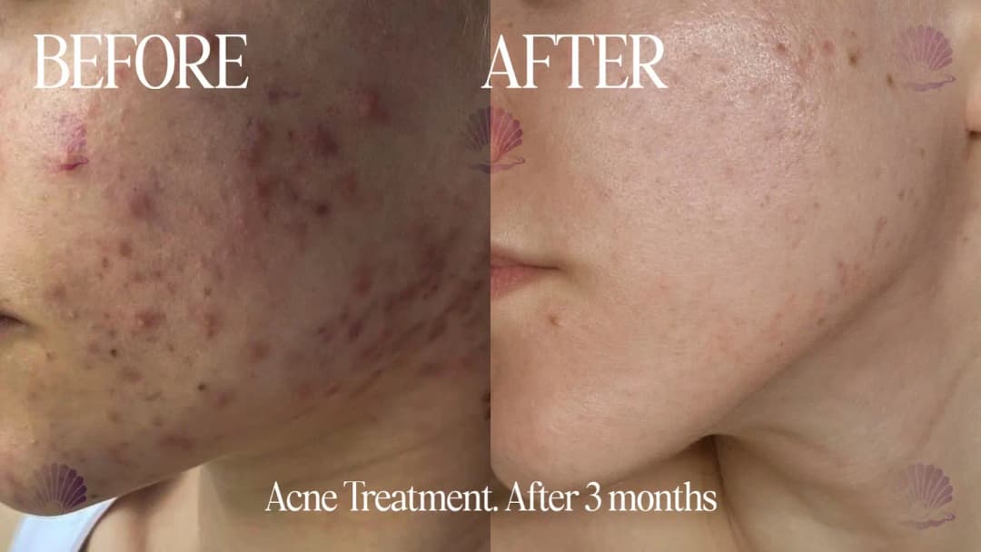 Pearl skin poly clinic photo 5