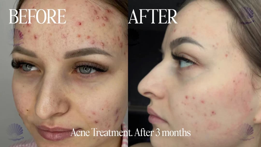 Pearl skin poly clinic — صورة 6