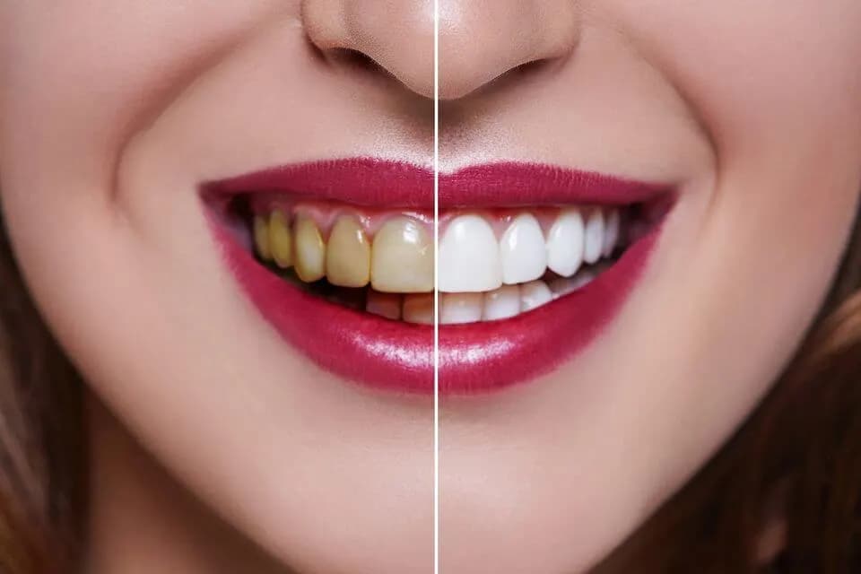 Pearly White Dental Clinic photo 2