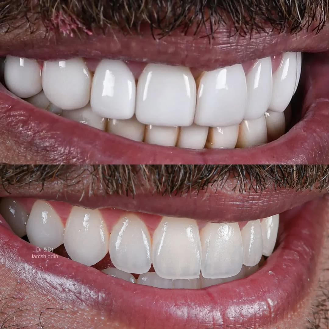 Proper Esthtic Dental Clinic photo 2