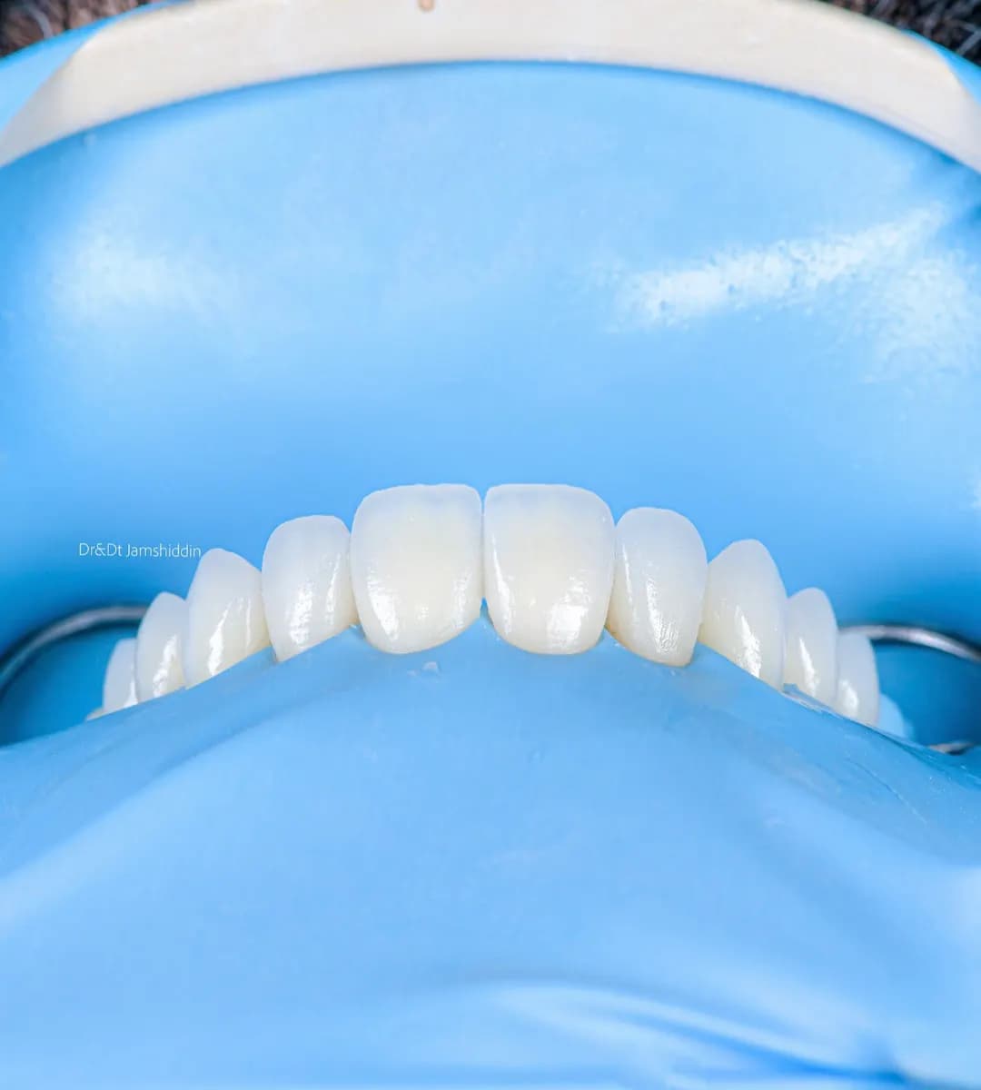 Proper Esthtic Dental Clinic photo 3