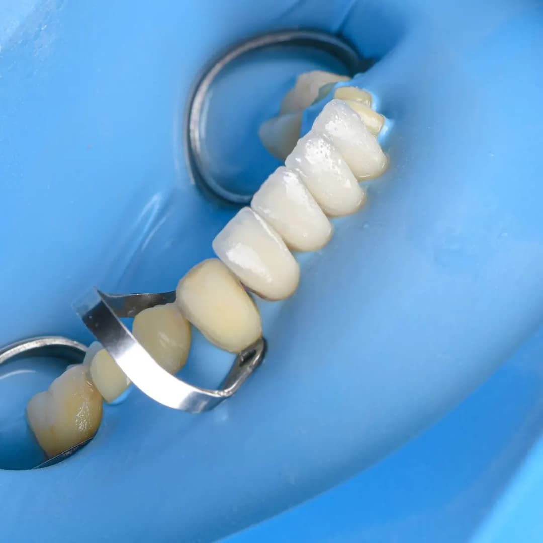 Proper Esthtic Dental Clinic photo 4