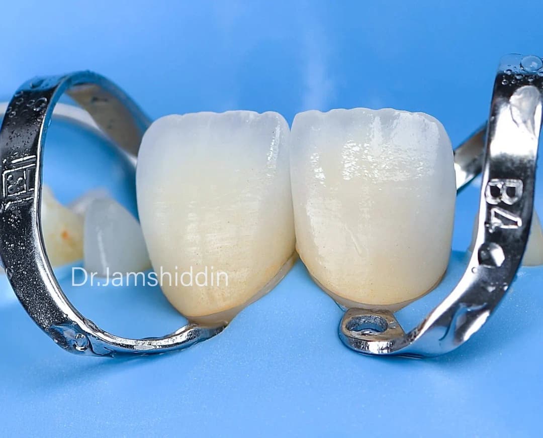 Proper Esthtic Dental Clinic — صورة 6