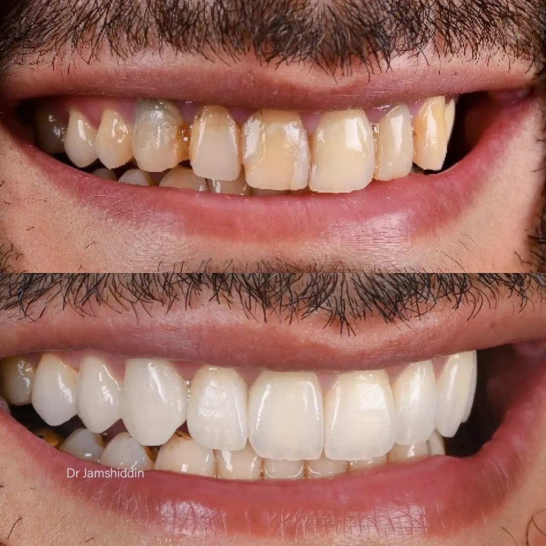 Proper Esthtic Dental Clinic — صورة 8