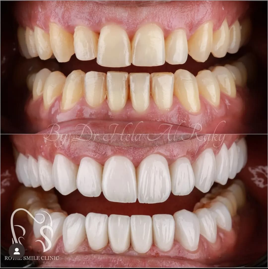 Royal Smile Dental Clinic