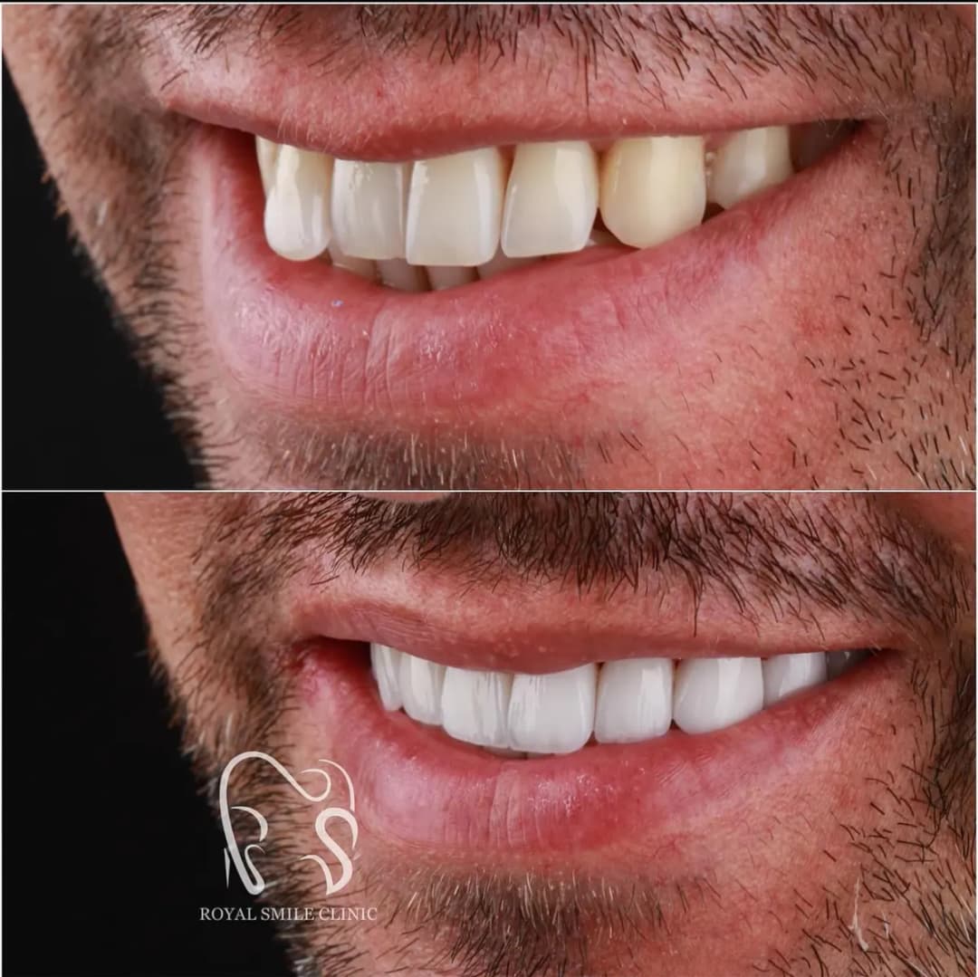 Royal Smile Dental Clinic — صورة 7