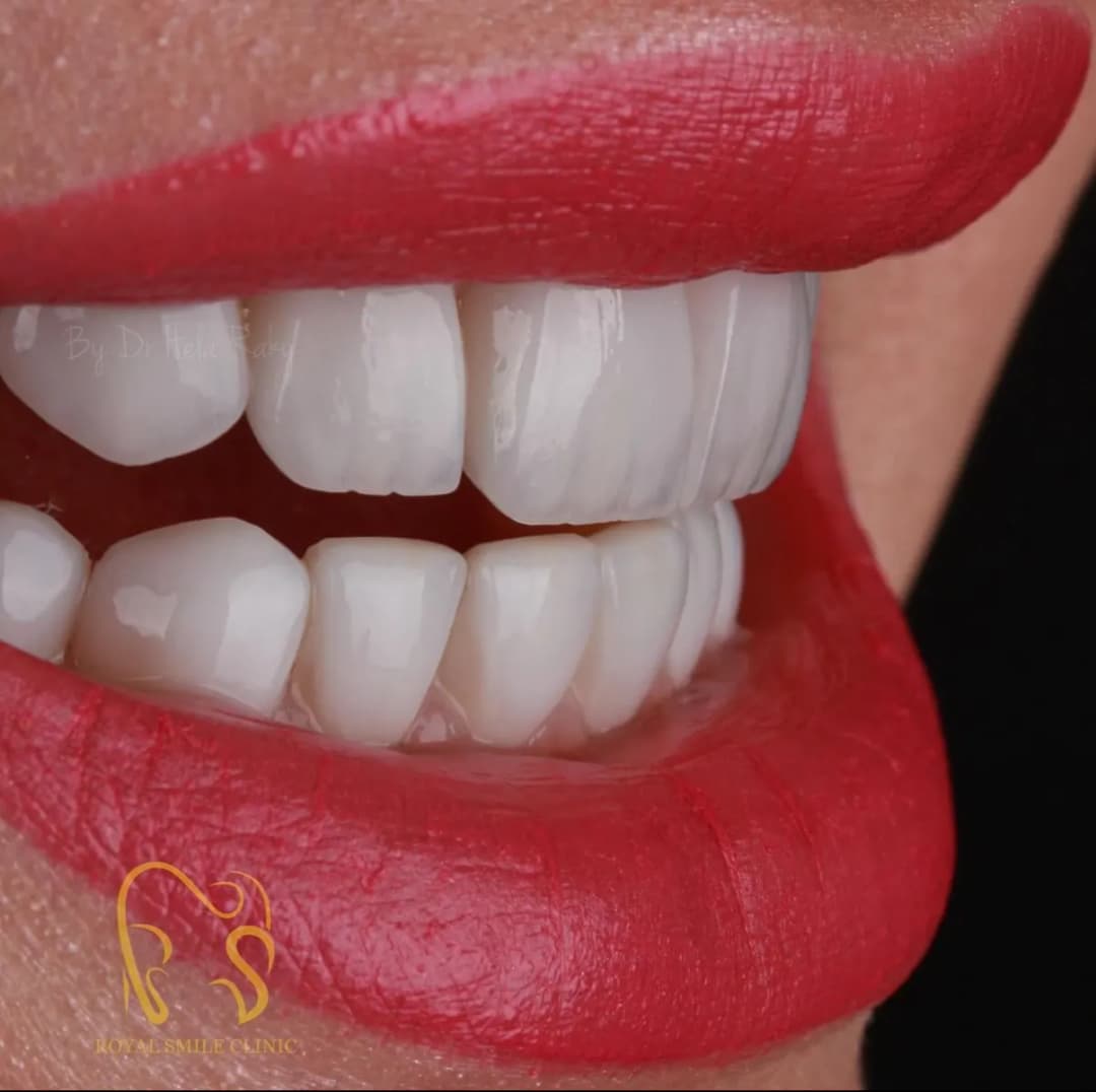 Royal Smile Dental Clinic — صورة 8