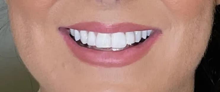 Signature By Dr Naeem Orthodontic And Dentofacial Aesthetic photo 5