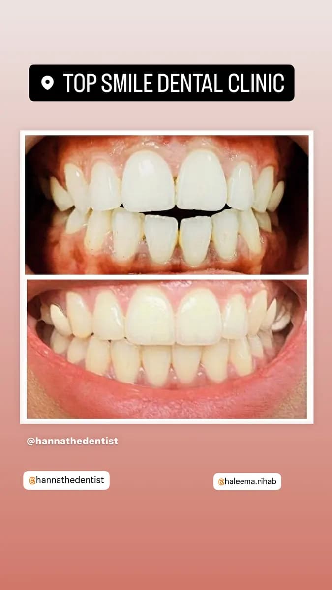 Top Smile Dental Clinic — صورة 7