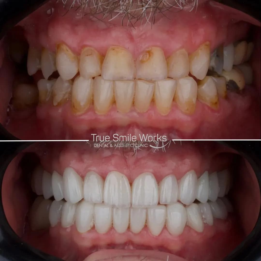 True Smile Works Dental Network photo 3