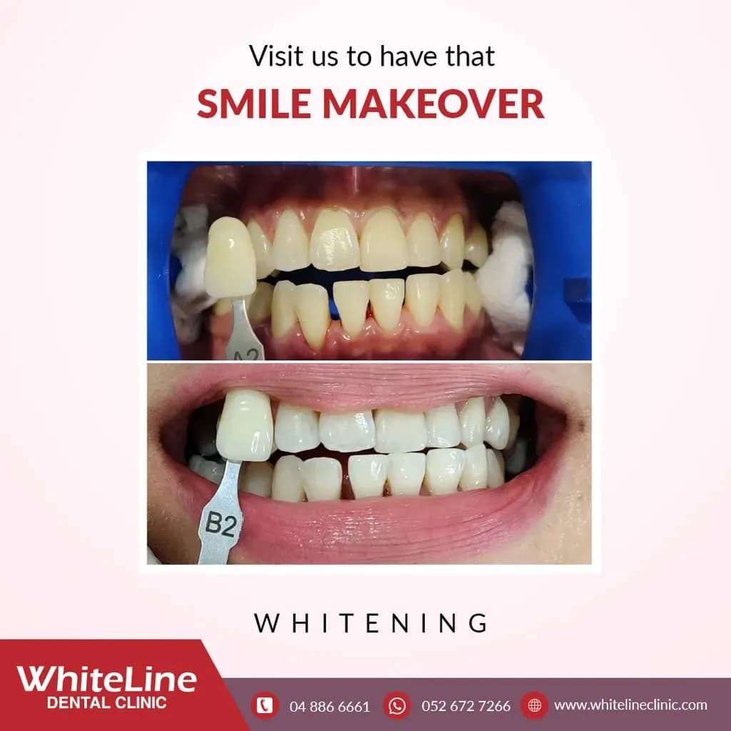 White Line Dental Clinic photo 4