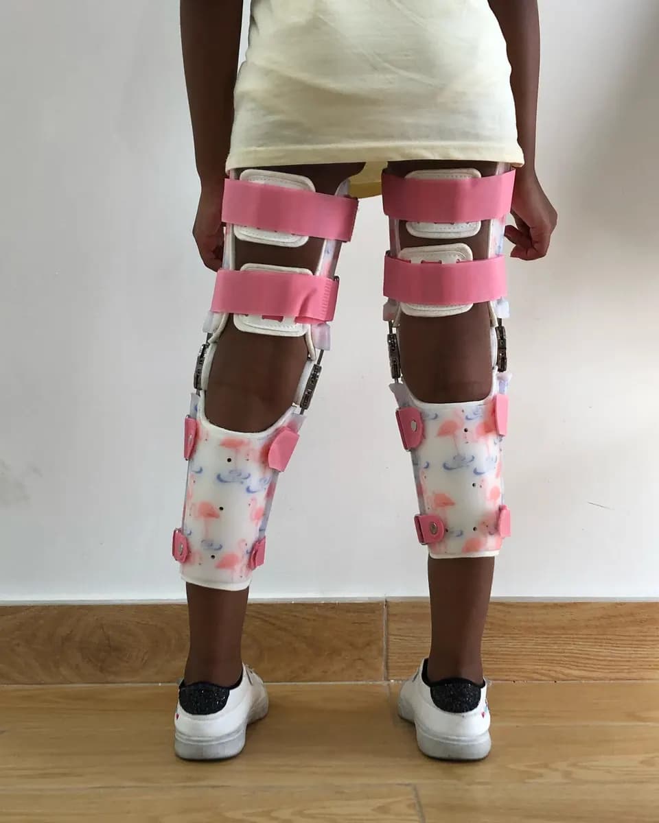 Xtremity Prosthetics & Orthotics photo 5