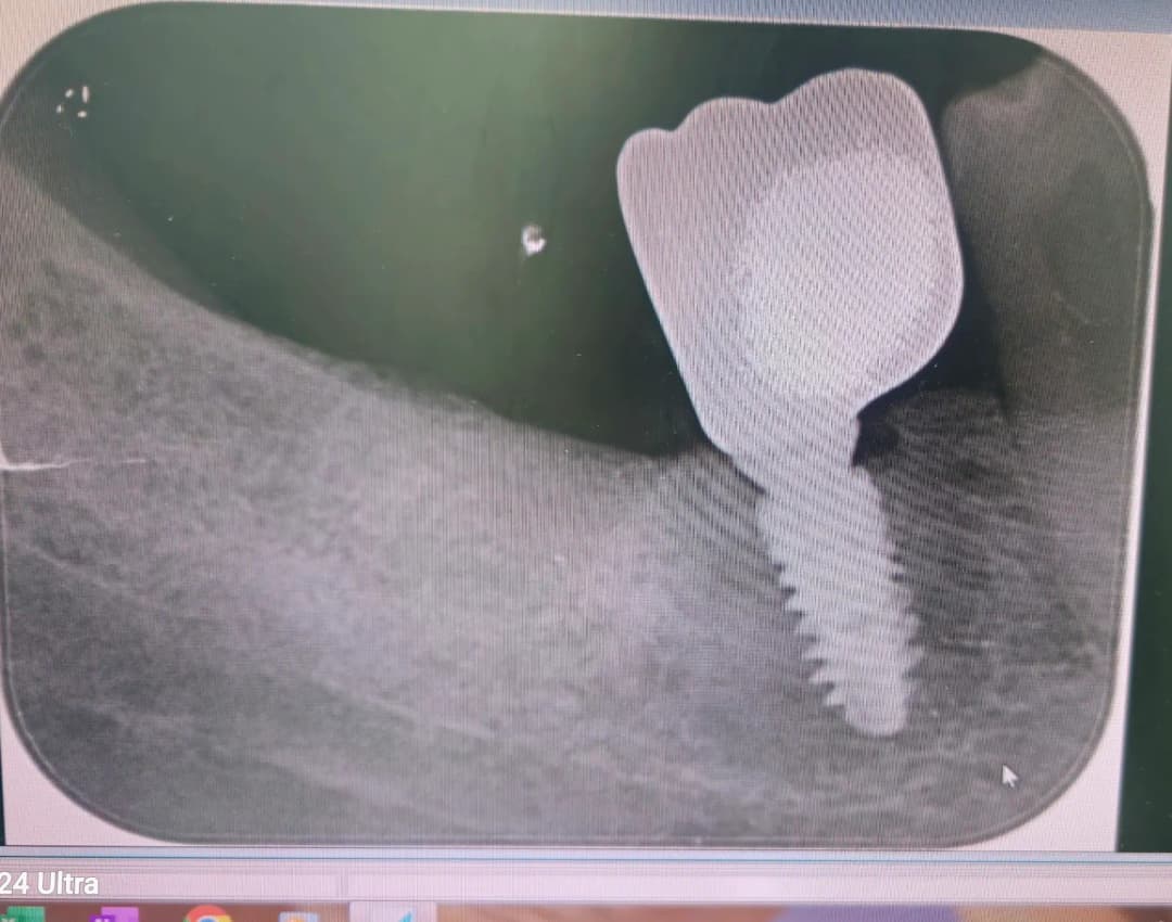 Z O E Dental Clinic — صورة 8