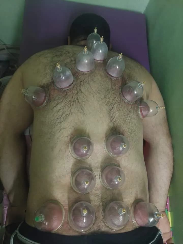 AL Maearif For Cupping Center photo 4
