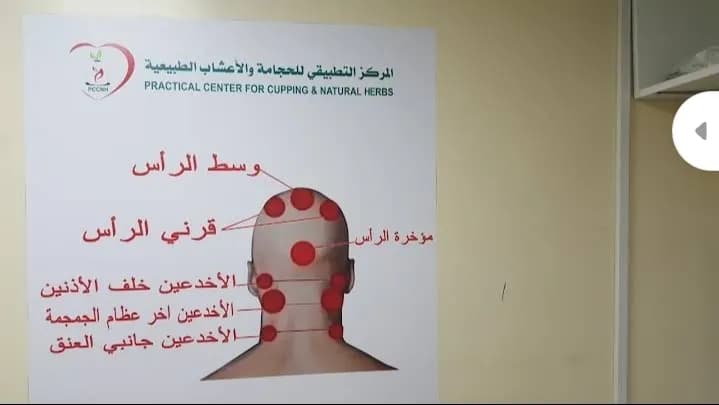 AL Maearif For Cupping Center photo 5