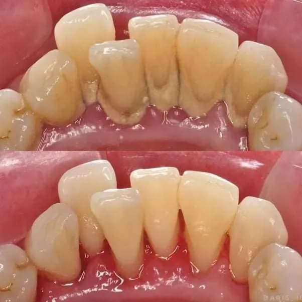 AL Ameera Dental Clinic
