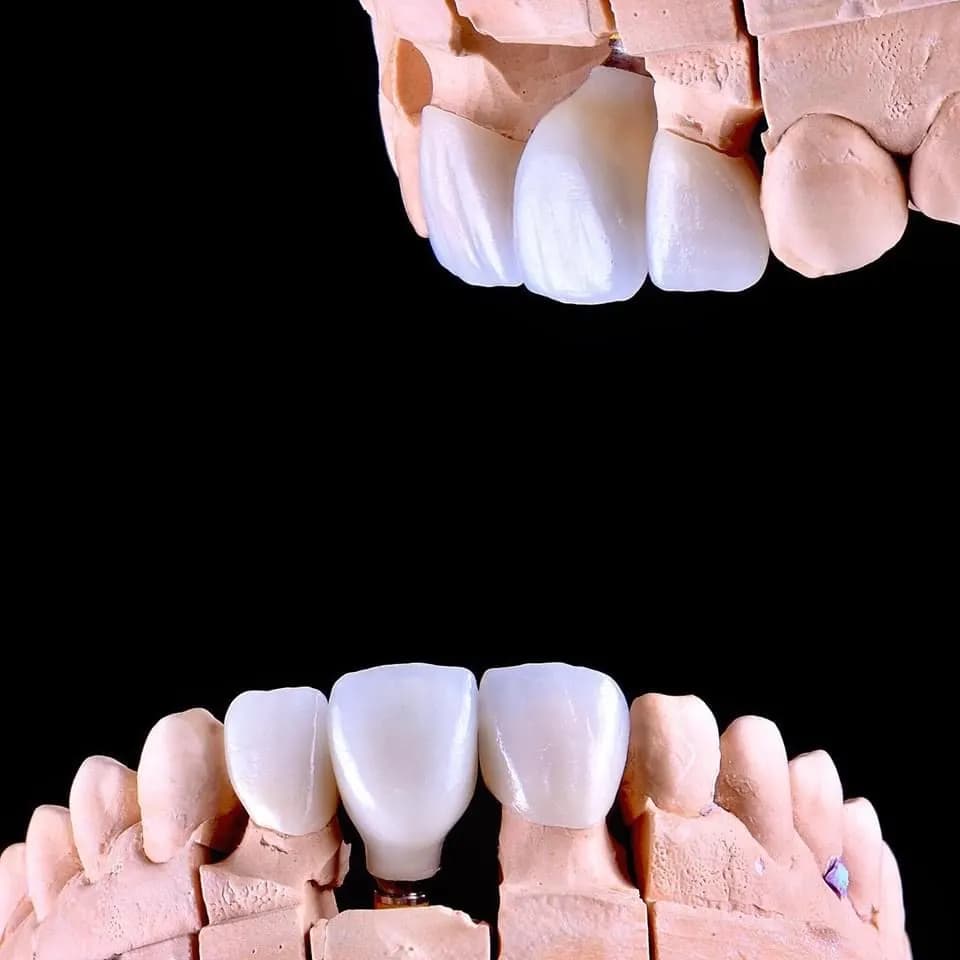 Smile Guide Dental Laboratory