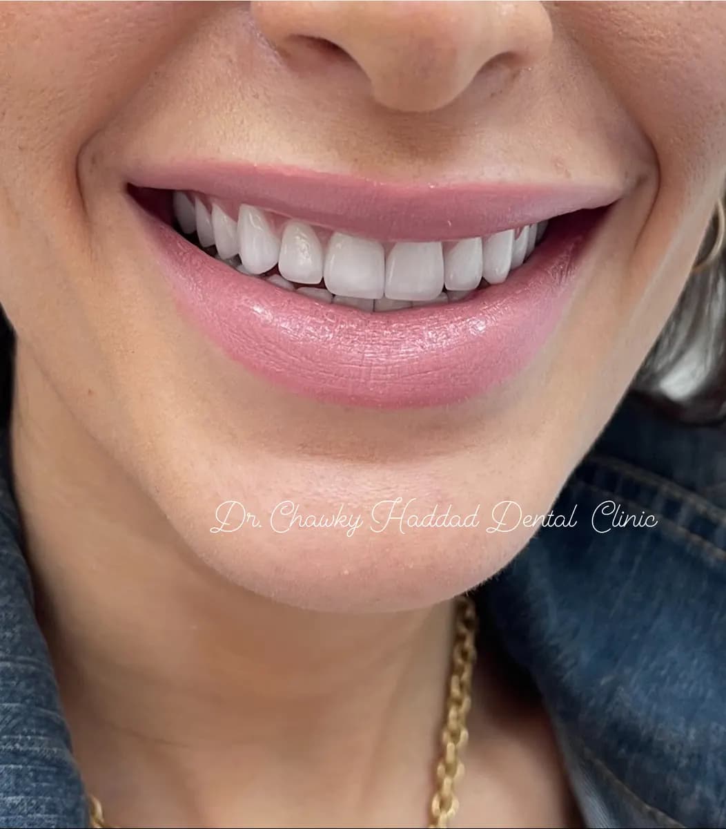 DR. Chawky Haddad Dental Clinic
